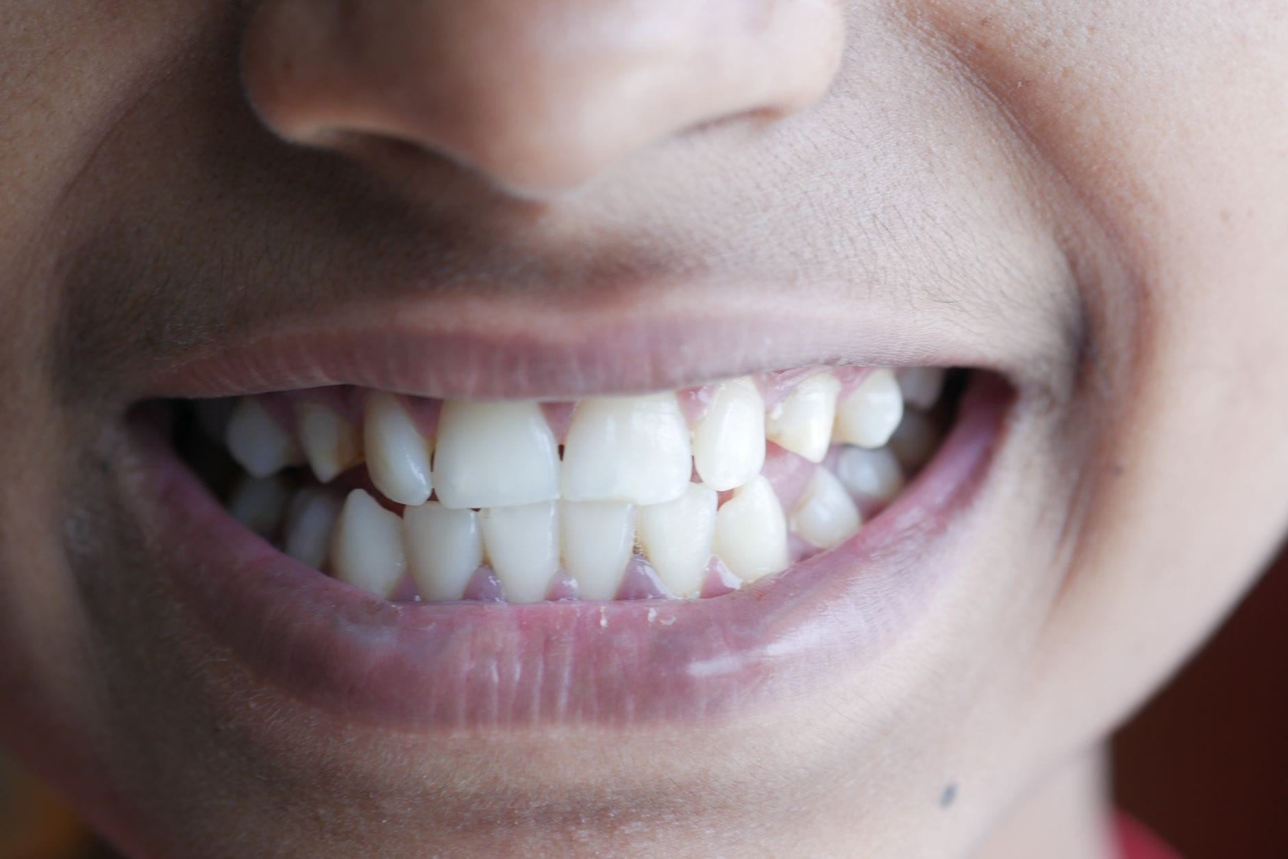 Protects Your Teeth