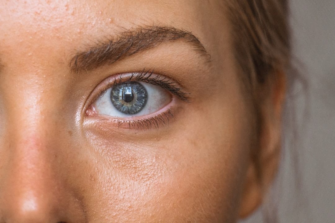 Calms Acne and Fights Microbes