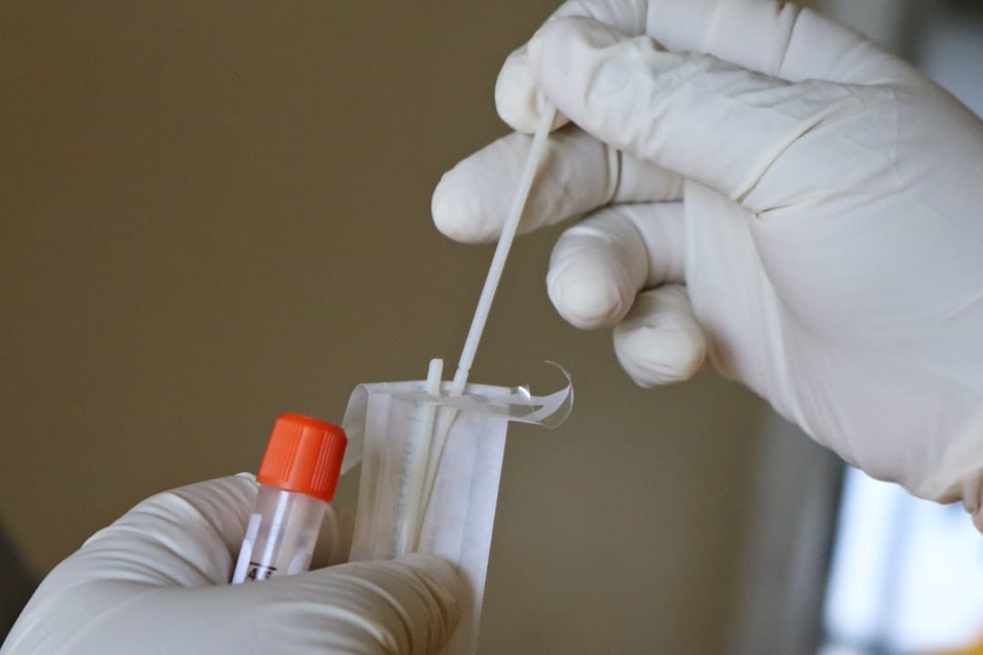 Clinician using a cotton swab to sample the back of a patient's throat