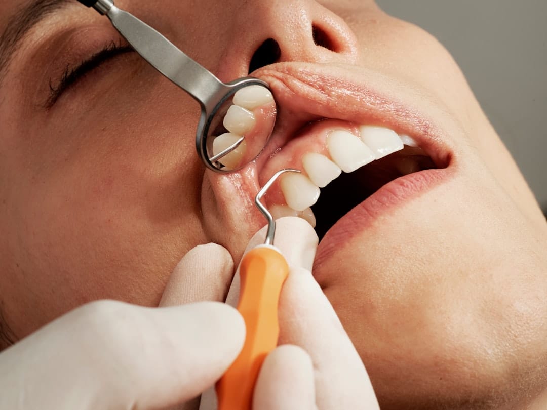 dentist dental checkup