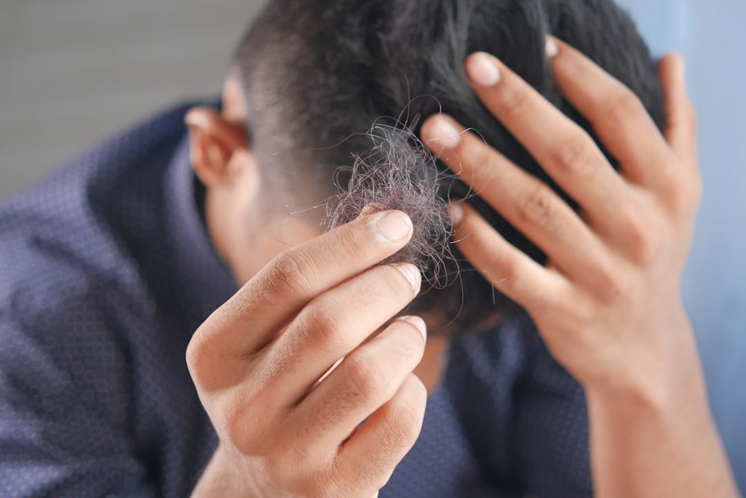 Calm a Flaky Scalp