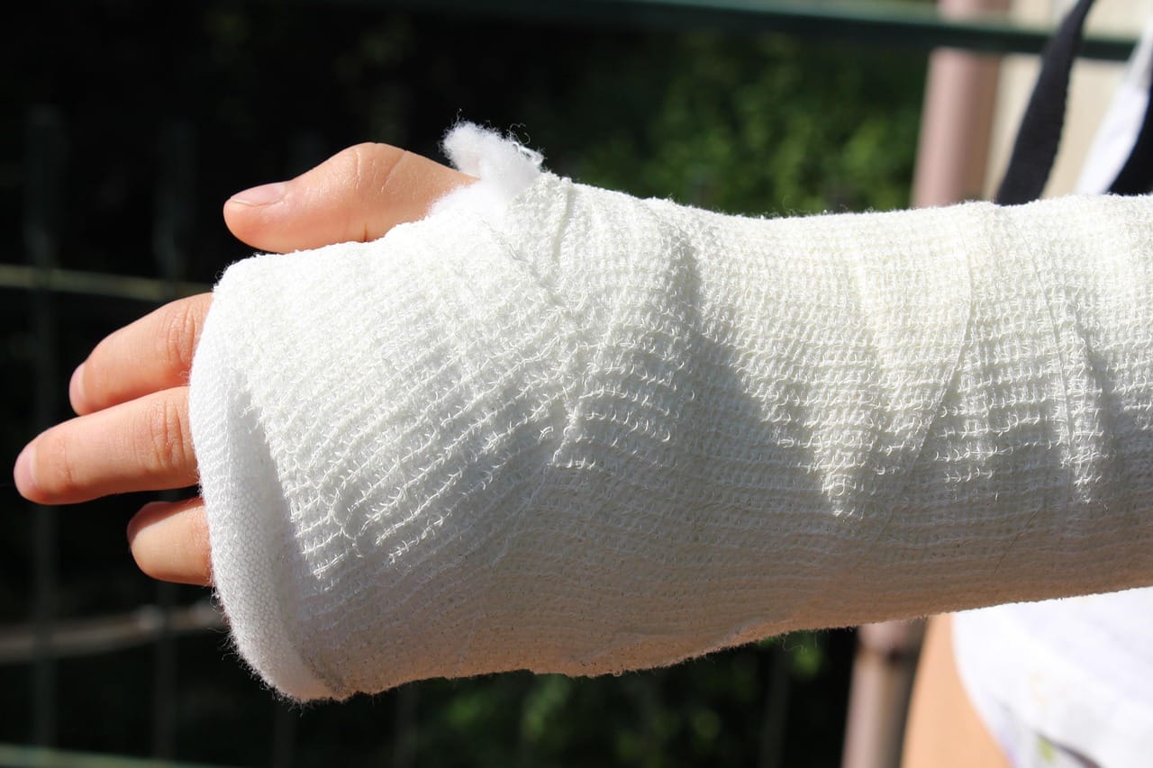A forearm wrapped in white gauze bandage resting on a wooden table