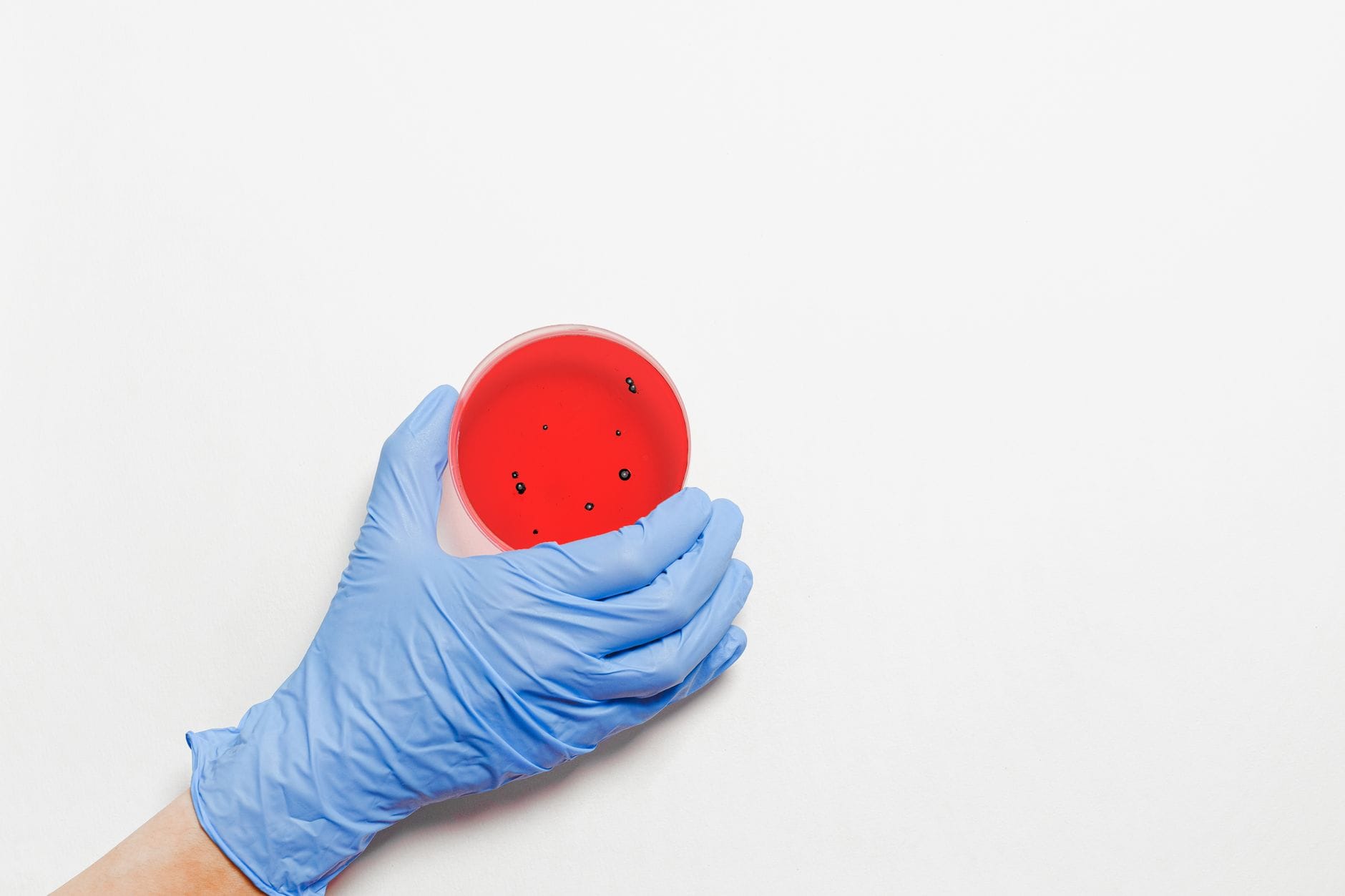 Bacterial colonies growing on a red agar plate under lab lighting