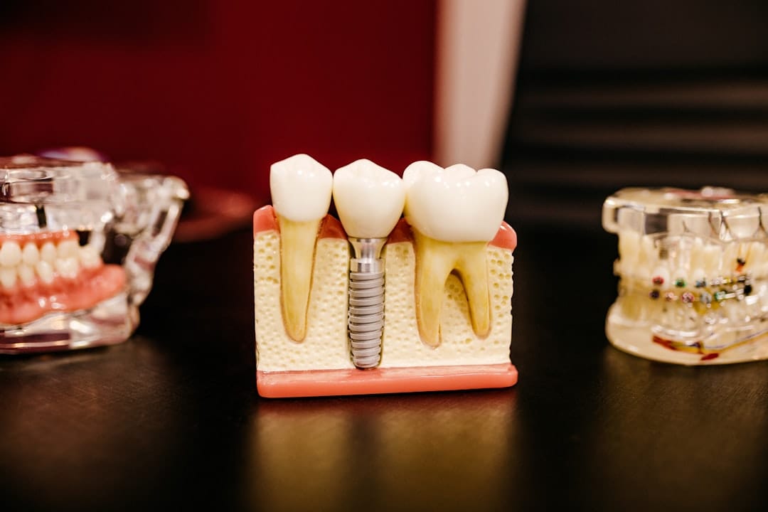 close-up dental model and metal mirror on a clinic tray