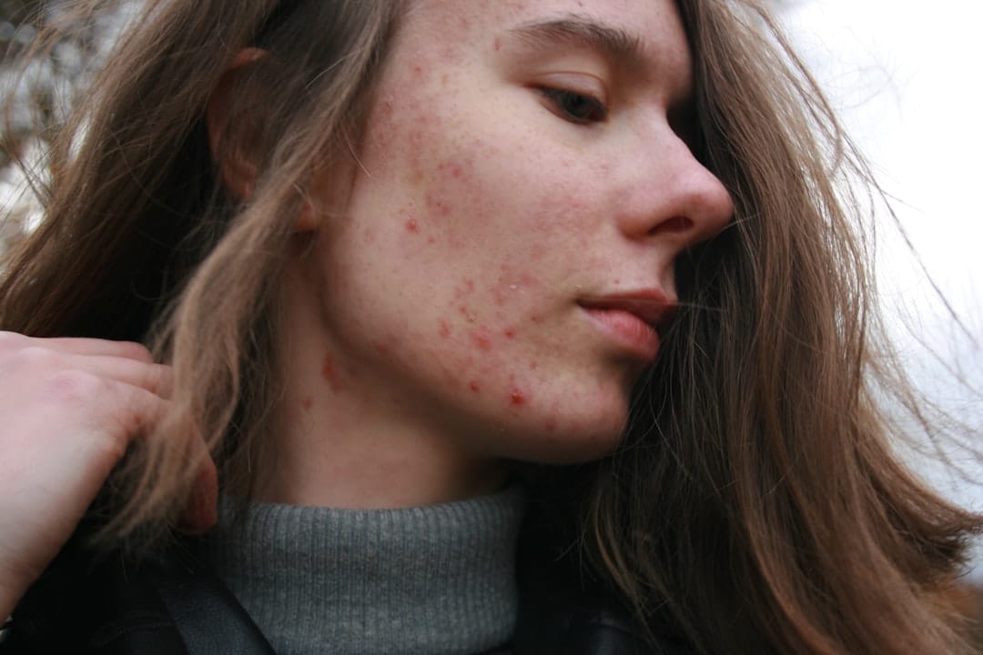 Close-up of reddened, irritated skin on a person's cheek