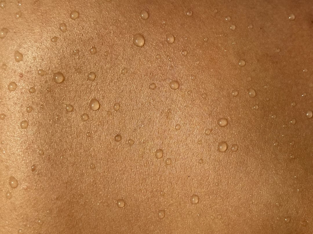 Close-up of reddened sun-exposed skin on a person's shoulder